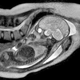 Illustration for article titled Groundbreaking MRI Shows Childbirth From The Inside